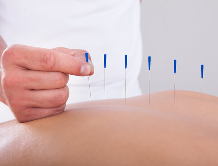 Alex Szabo Osteopathy - Medical Acupuncture